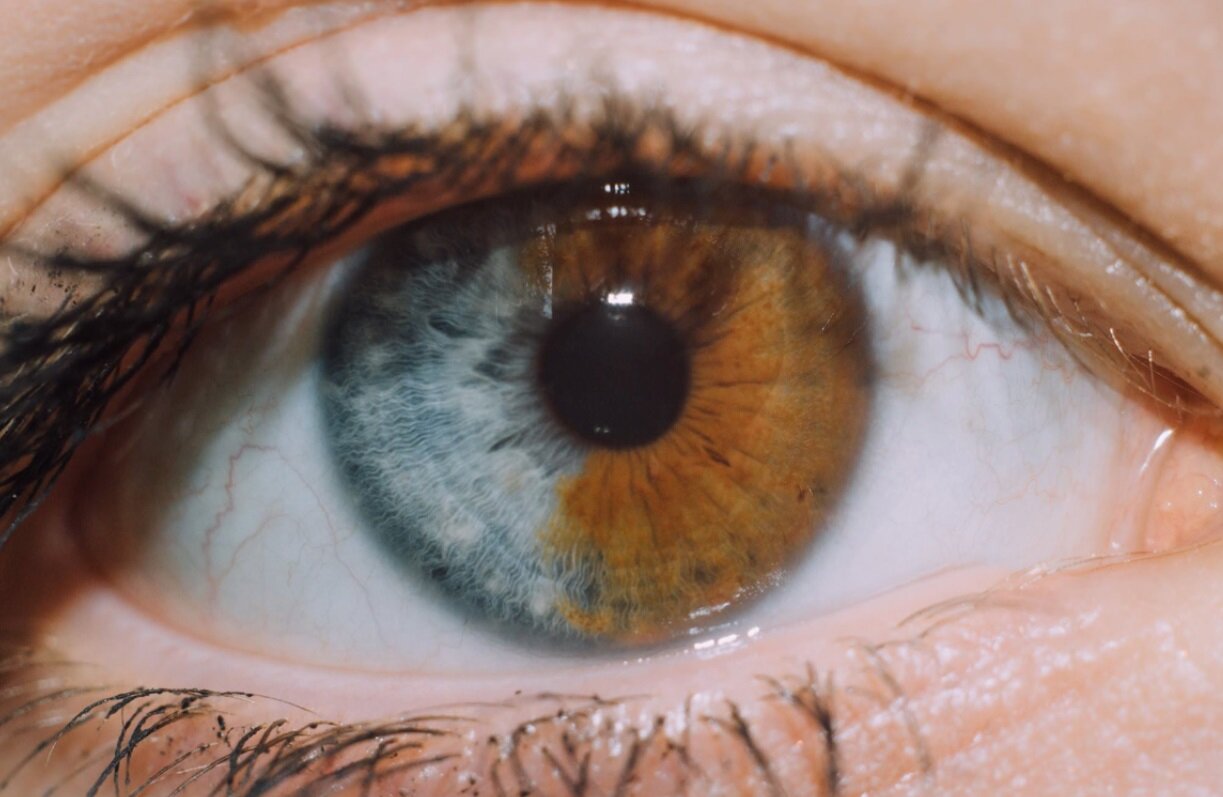 وقتی رنگ چشمها متفاوت است/ عکس