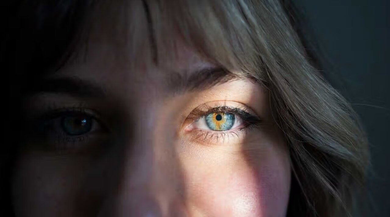 وقتی رنگ چشمها متفاوت است/ عکس