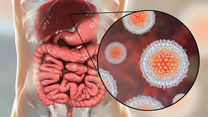 جنجال ابتلای مدافع پرسپولیس به هپاتیت B؛ این بیماری چیست؟/ روشهای انتقال
