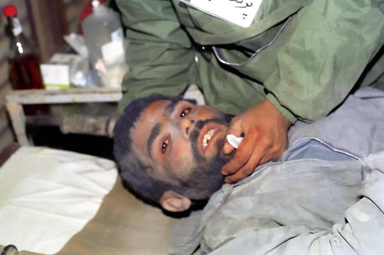 تصاویری از بهداری رزمی در دوران دفاع مقدس/ تقویت مجروحین با کمپوت سیب